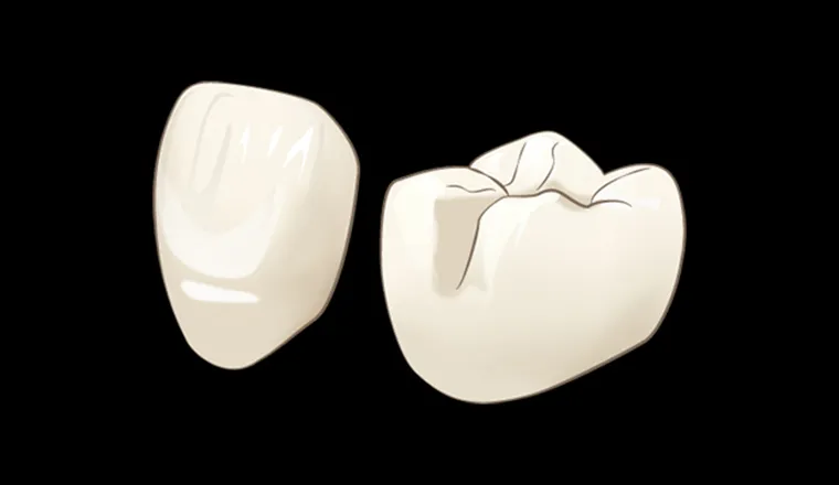 オールセラミッククラウン｜シティデンタルクリニック そよらリーフシティ市川