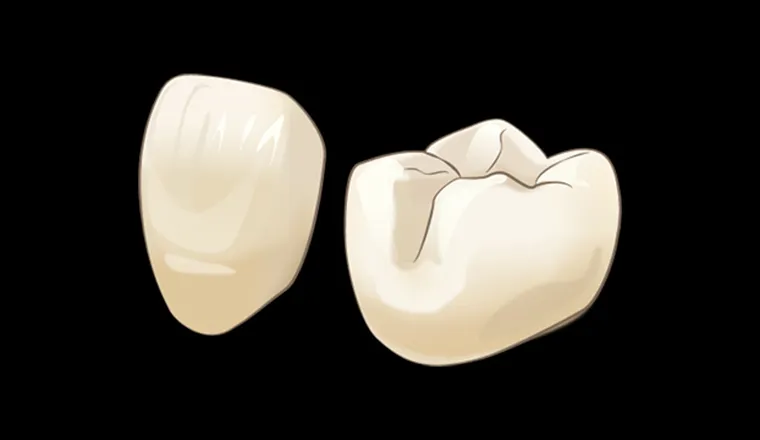 ジルコニアセラミッククラウン｜シティデンタルクリニック そよらリーフシティ市川