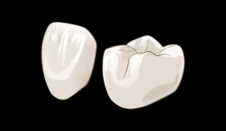 オールジルコニアクラウン｜シティデンタルクリニック そよらリーフシティ市川