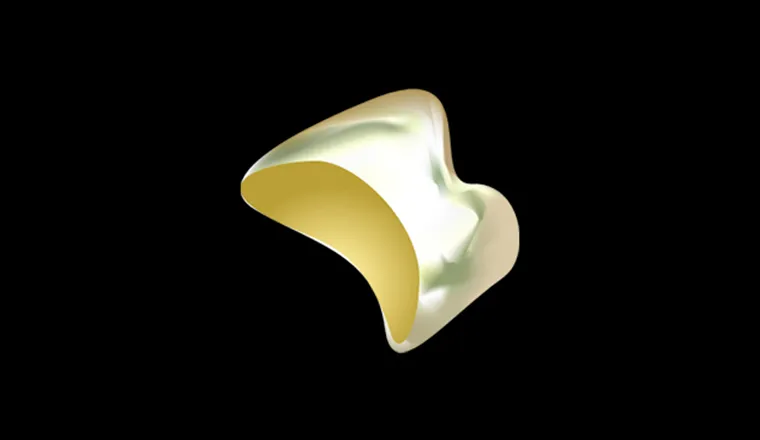 ゴールドクラウン｜シティデンタルクリニック そよらリーフシティ市川