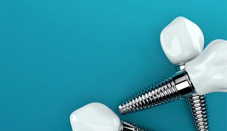 何種類ものインプラントから材料を厳選｜シティデンタルクリニック そよらリーフシティ市川