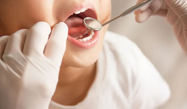 シーラント｜シティデンタルクリニック そよらリーフシティ市川