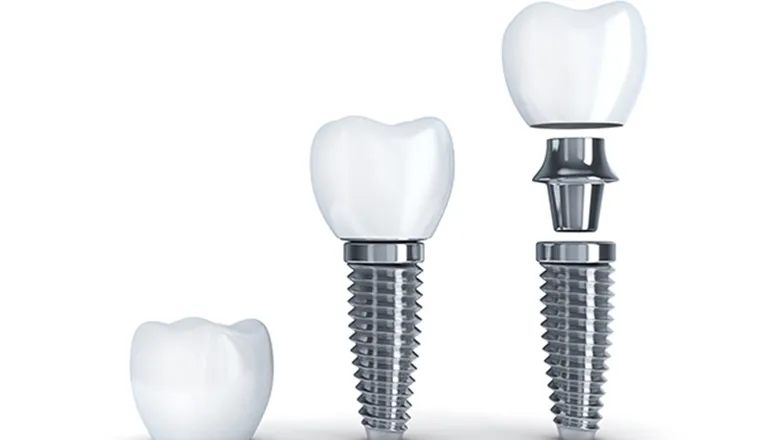 C2｜シティデンタルクリニック そよらリーフシティ市川