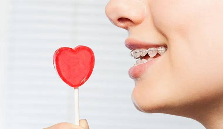 部分矯正（MTM）｜シティデンタルクリニック そよらリーフシティ市川