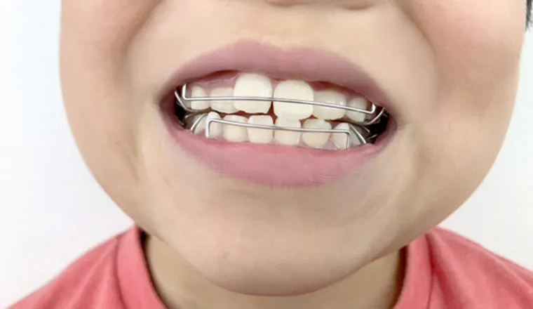 拡大装置｜シティデンタルクリニック そよらリーフシティ市川