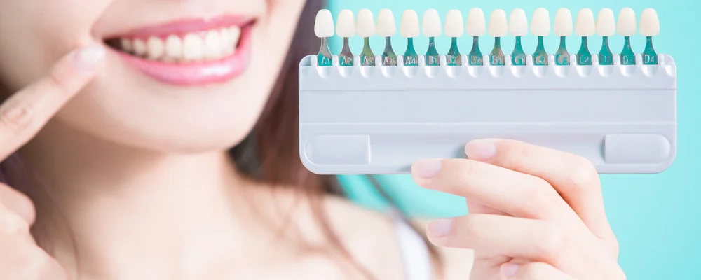 シェードガイドを持ち歯の色の変化を確かめる女性｜シティデンタルクリニック そよらリーフシティ市川